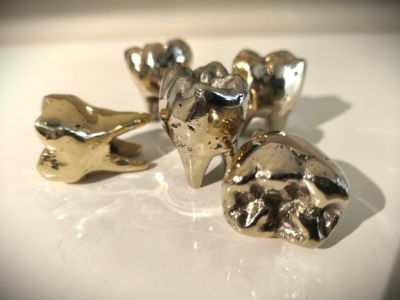 Molaires Bronze